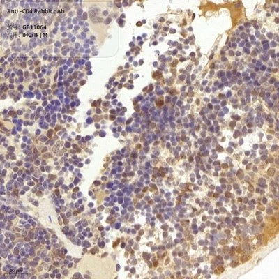 Anti-CD4-Kaninchen-Pab